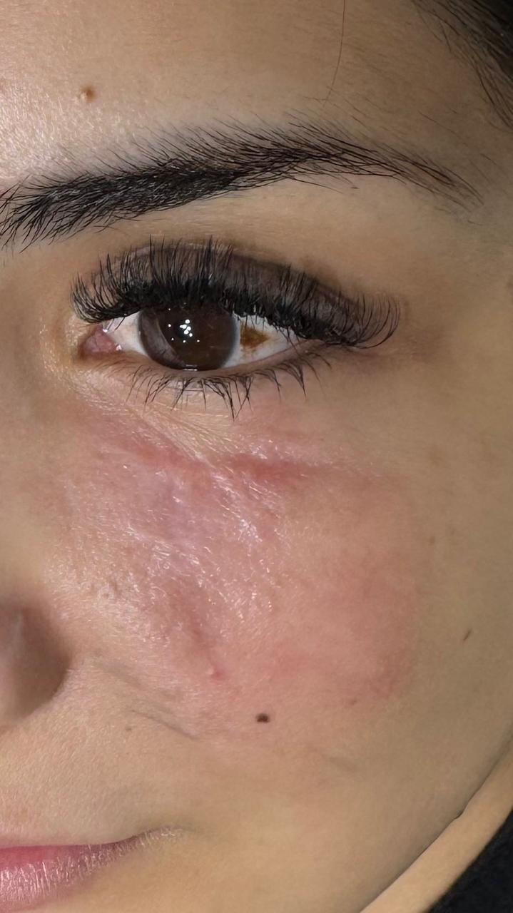 Reconstrucción Caso 2 - Antes