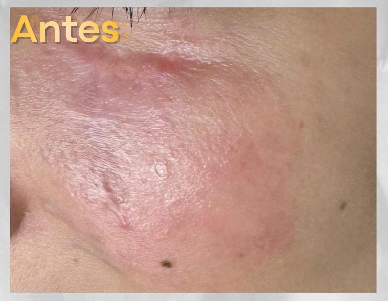 Medicina Reconstructiva - Antes