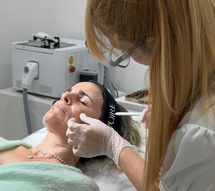 Ultherapy procedure 1